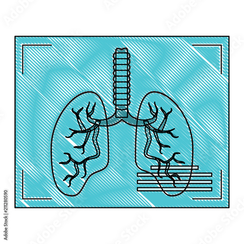 Lungs xray icon over white background, vector illustration