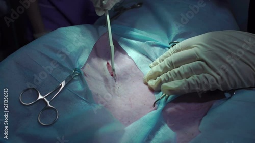 The scalpel surgeon cuts the skin