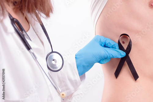 Oncological disease concept. Doctor wearing white coat and stethoscope in gloves putting black ribbon as a symbol of melanoma cancer over melanoma on man’s skin. photo