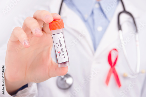 Oncological disease concept. Doctor wearing white coat with pinned a red ribbon as a symbol of aids and stethoscope holding positive tumor marker.