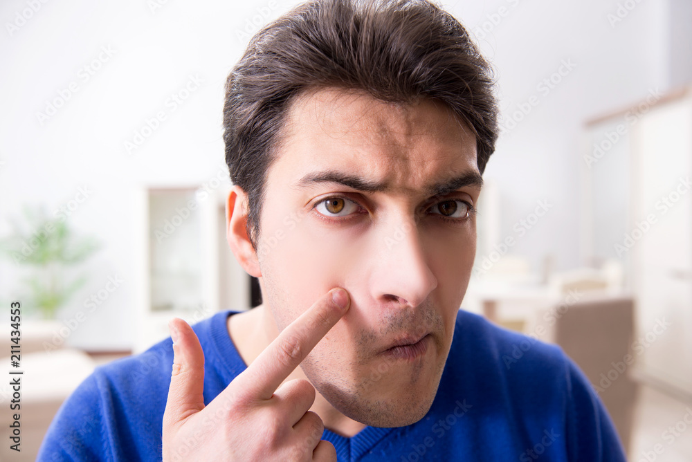 Man panicking because of pimples on the skin Man panicking because of pimples on the skin