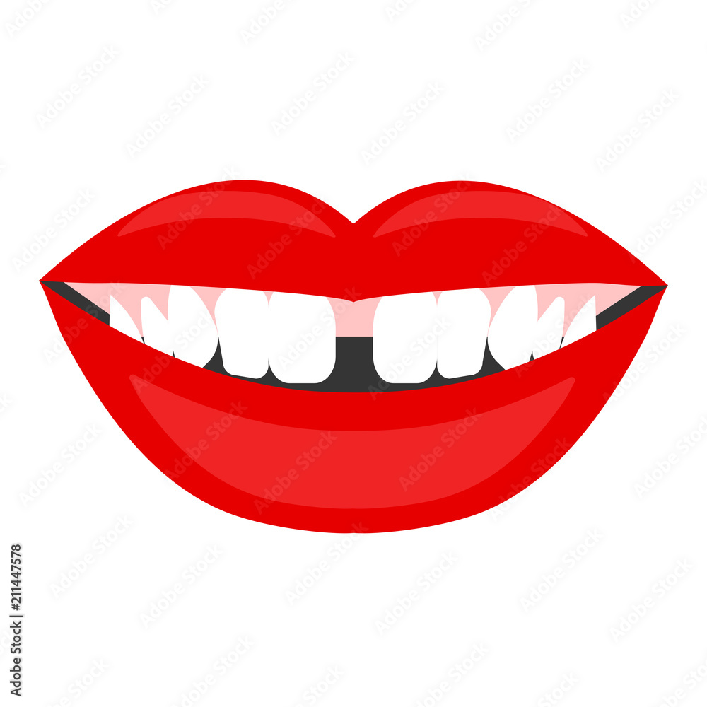 Diastema, gap between teeth Diastema, gap between teeth