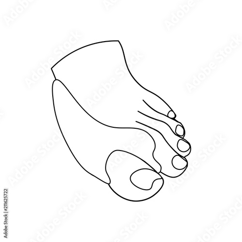 Hallux valgus orthopedic support