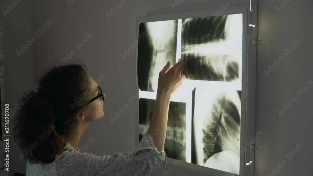 standing near the lamp and considers x-rays pictures. takes 1 in hand.