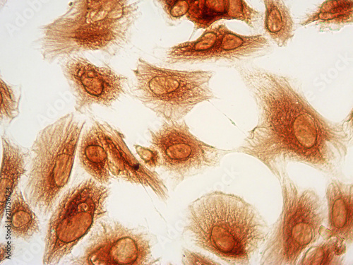 Photomicrograph of human endometrial stromal cells stained immunocytochemically for vimentin protein (brown), 40x magnification. Microscopy, biology, science, macro, view, background.