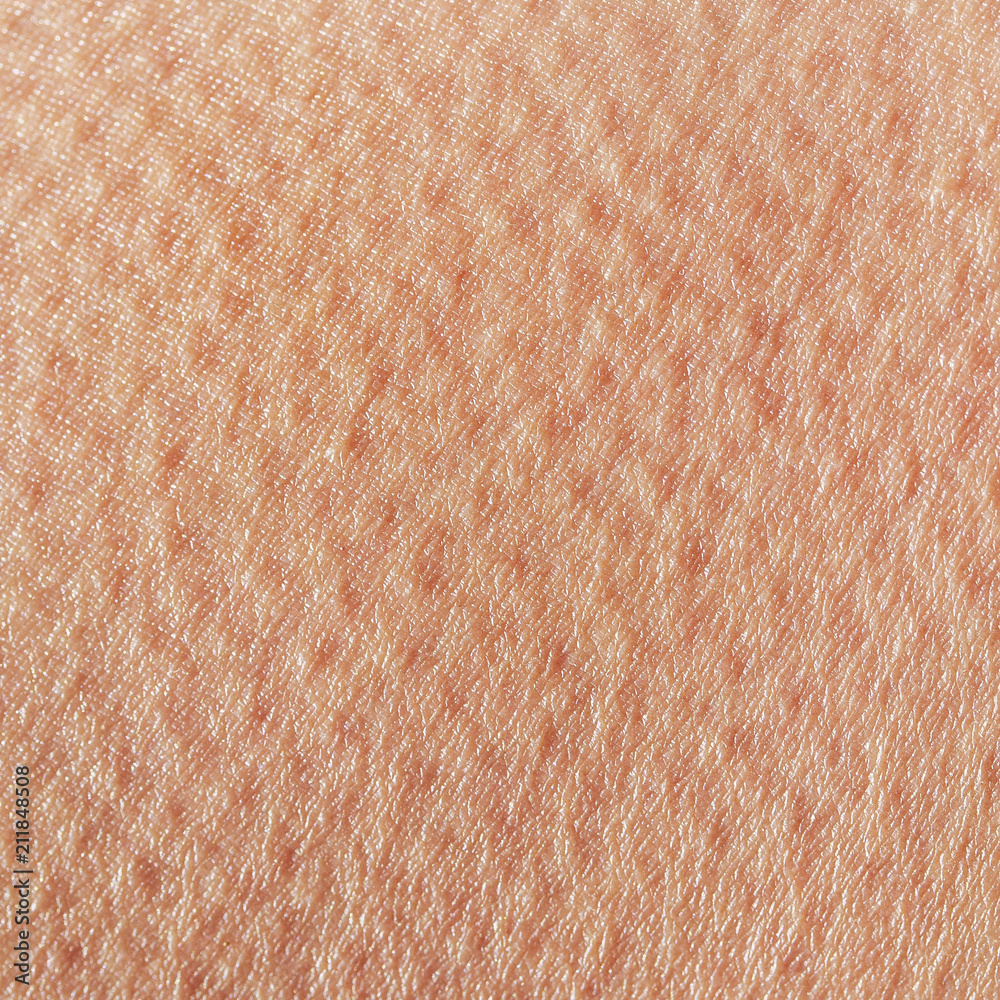 background of a texture of a tanned young female skin of a man covered with  pores Stock Photo | Adobe Stock