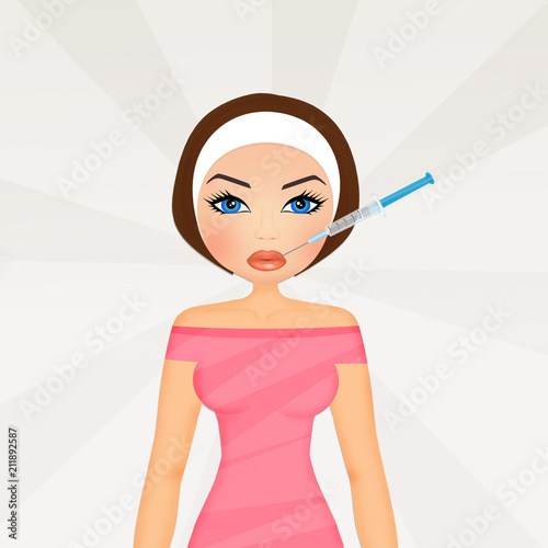 Obraz na płótnie illustration of lip augmentation