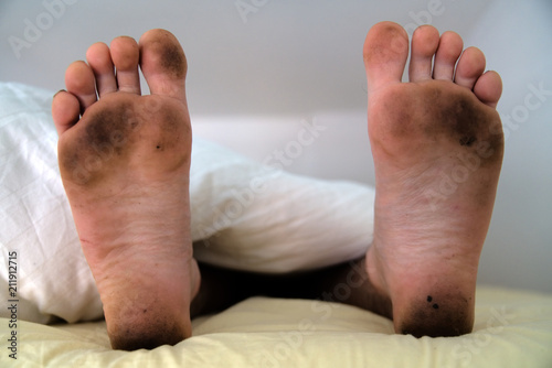 Dirty bare feet of a sleeping person showing out of the blanket on a bed photo