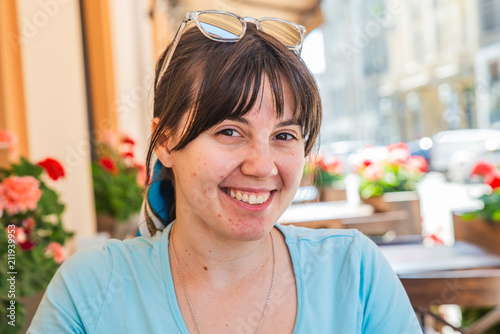 Tableau sur toile woman portrait with acne on face.