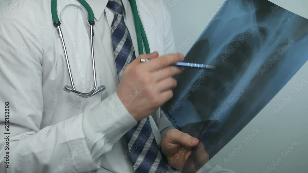 This video features a close-up shot of a male doctor standing at his office, he is holding and analyzing x-ray scan of patient`s lungs. This video features a close-up shot of a male doctor standing at his office, he is holding and analyzing x-ray scan of patient`s lungs.