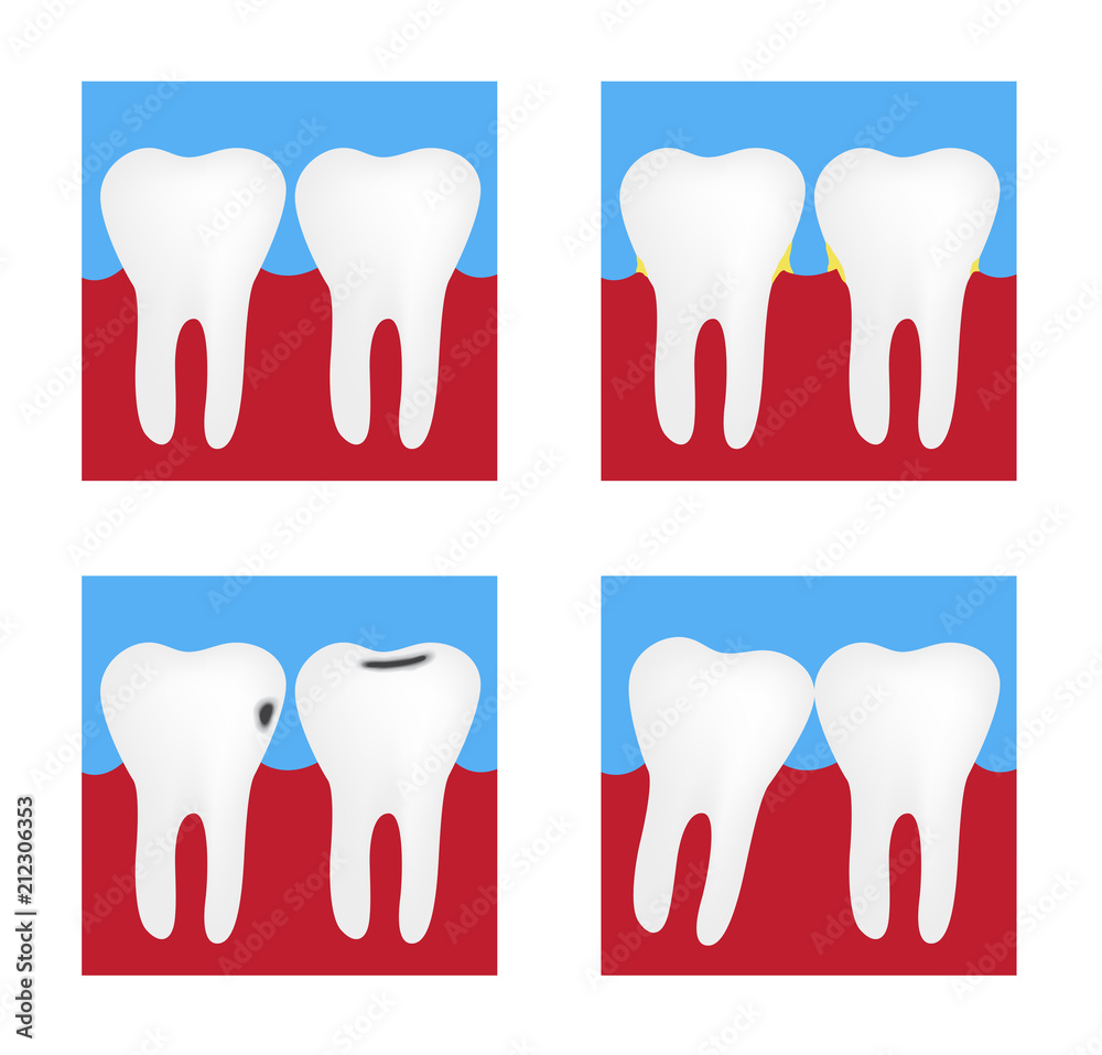 Dental Problems , Health Care of Tooth Set Dental Problems , Health Care of Tooth Set