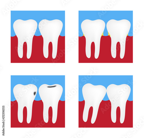 Dental Problems ,  Health Care of Tooth Set