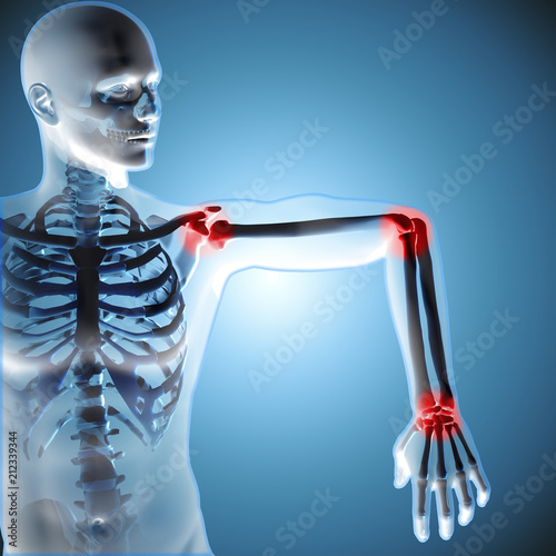 Print op canvas 3d medical figure showing his arm joints