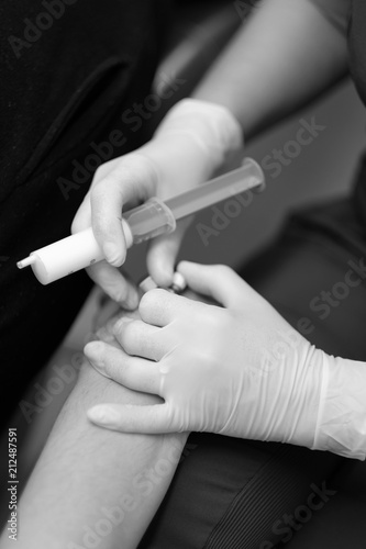 The hands of a doctor preparing a patient for intravenous administration of the drug through a catheter