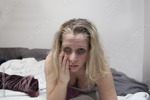 Photos Rough night or morning