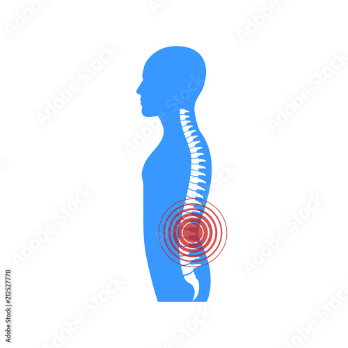 Spine pain. Vector.