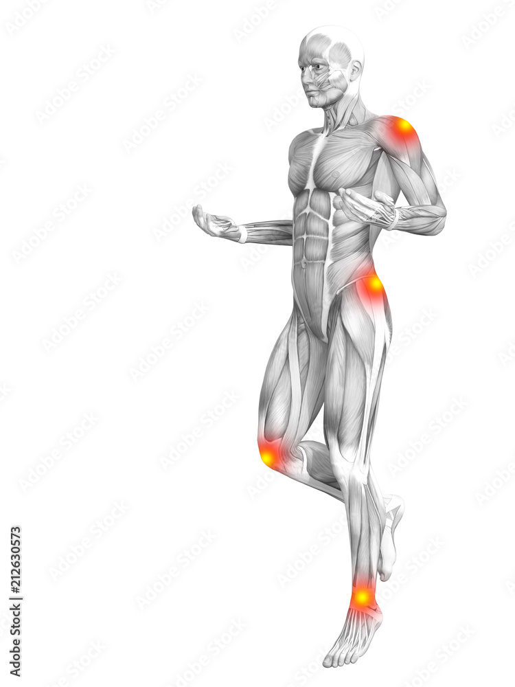 Conceptual human muscle anatomy with red and yellow hot spot inflammation or articular joint pain for health care therapy or sport concepts. 3D illustration man arthritis or bone osteoporosis disease Conceptual human muscle anatomy with red and yellow hot spot inflammation or articular joint pain for health care therapy or sport concepts. 3D illustration man arthritis or bone osteoporosis disease