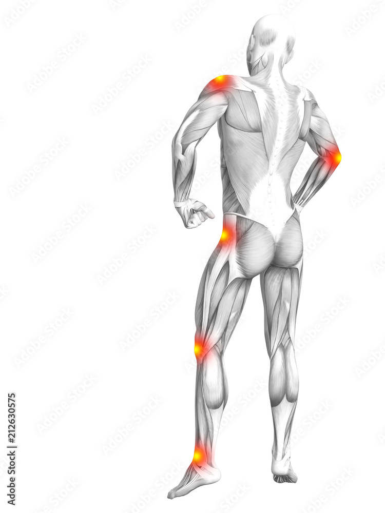 Conceptual human muscle anatomy with red and yellow hot spot inflammation or articular joint pain for health care therapy or sport concepts. 3D illustration man arthritis or bone osteoporosis disease Conceptual human muscle anatomy with red and yellow hot spot inflammation or articular joint pain for health care therapy or sport concepts. 3D illustration man arthritis or bone osteoporosis disease