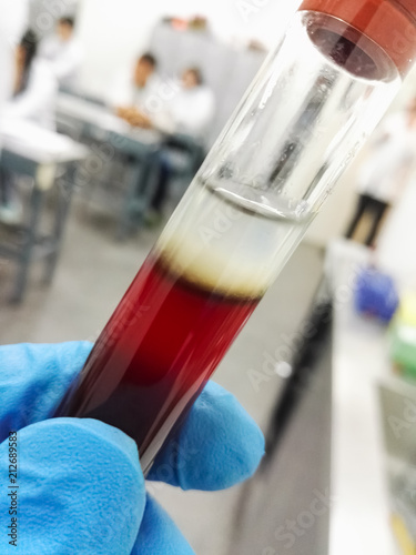 Tubo de ensayo con extracción de ADN a partir de sangre en una clase universitaria de bioquímica