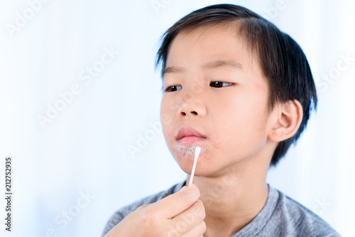 Wallpaper Mural Close up of lips affected by herpes. Torontodigital.ca