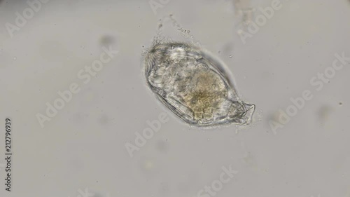 egg creeping Rotatoria under a microscope