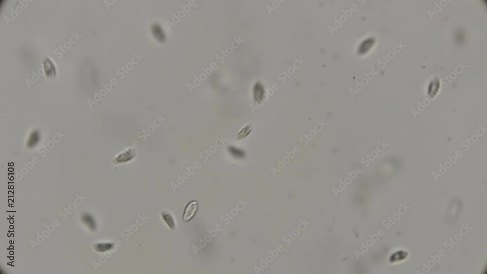 colony of the simplest microorganisms including parasites under a microscope colony of the simplest microorganisms including parasites under a microscope