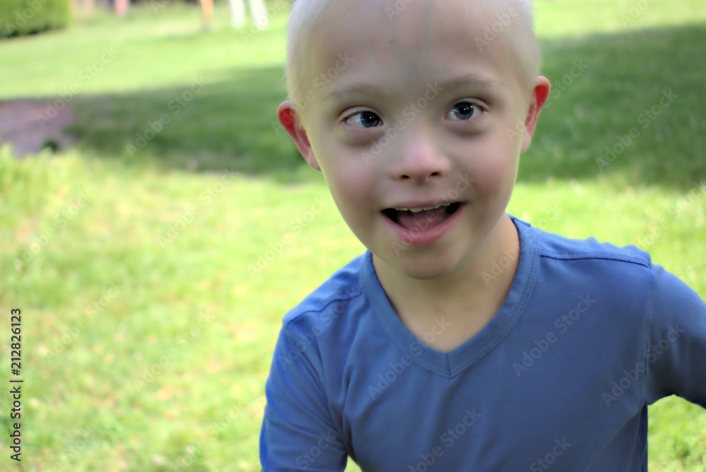 Defect,childcare,medicine and people concept- young boy with a down syndrome who is playing in a park. Defect,childcare,medicine and people concept- young boy with a down syndrome who is playing in a park.