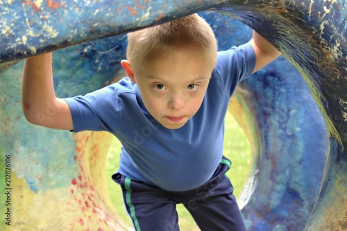 Defect,childcare,medicine and people concept- young boy with a down syndrome who is playing in a park.