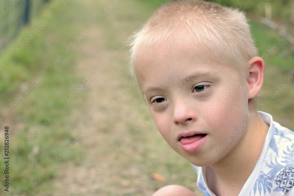 Defect,childcare,medicine and people concept- boy with down syndrome poses for a portrait outdoors. Defect,childcare,medicine and people concept- boy with down syndrome poses for a portrait outdoors.