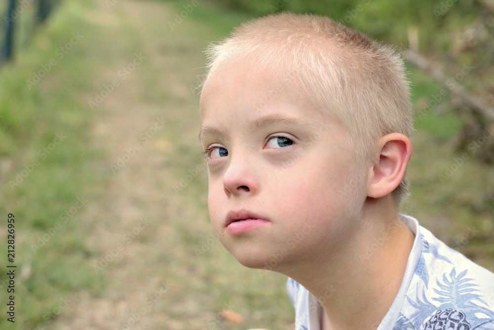 Defect,childcare,medicine and people concept- boy with down syndrome poses for a portrait outdoors. Defect,childcare,medicine and people concept- boy with down syndrome poses for a portrait outdoors.