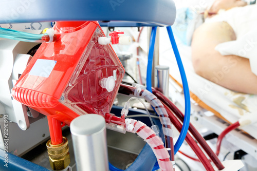 working ecmo machine in intensive care department