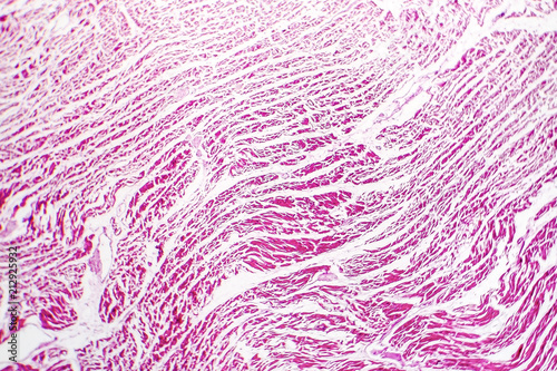Fotografie Brown atrophy of the heart, light micrograph, photo under microscope