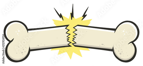 Broken Bone Line Cartoon Drawing Design. Vector Illustration Isolated On White Background
