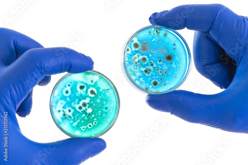 Φωτογραφία hand in blue glove holds petri dish with agar and bacterium colony, isolated