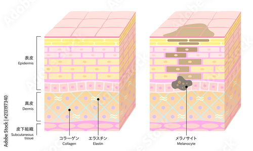 やさしい色合いの、立体的な肌の断面図。健康な肌とシミができた肌