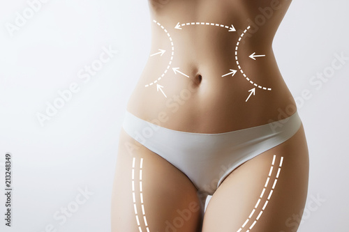 slim woman body with marks on stomach