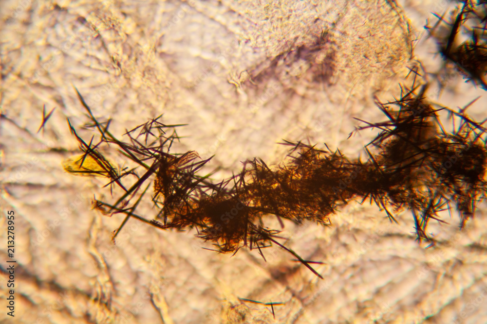 Fototapeta premium Tears viewed at the microscope. Magnification 100-1000x 