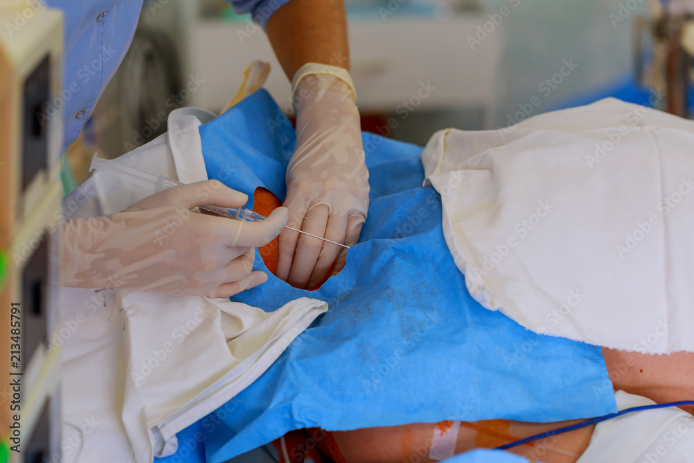Close up of surgery team operating Close up of surgery team operating