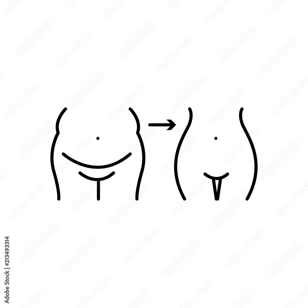 body before and after weight loss