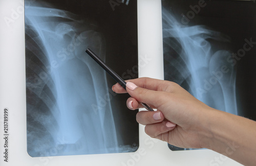 doctor shows x-ray