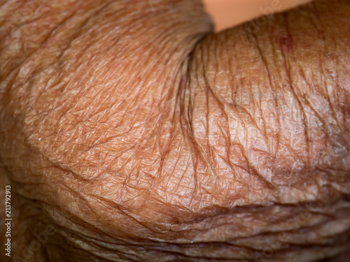 Wrinkles on The Skin of Elbow Joint