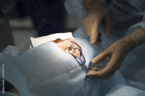 Laser surgery for vision correction