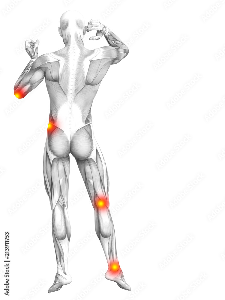 Conceptual human muscle anatomy with red and yellow hot spot inflammation or articular joint pain for health care therapy or sport concepts. 3D illustration man arthritis or bone osteoporosis disease Conceptual human muscle anatomy with red and yellow hot spot inflammation or articular joint pain for health care therapy or sport concepts. 3D illustration man arthritis or bone osteoporosis disease