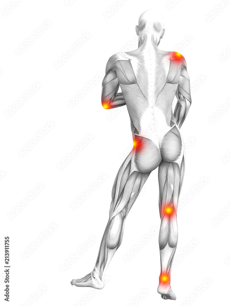 Conceptual human muscle anatomy with red and yellow hot spot inflammation or articular joint pain for health care therapy or sport concepts. 3D illustration man arthritis or bone osteoporosis disease Conceptual human muscle anatomy with red and yellow hot spot inflammation or articular joint pain for health care therapy or sport concepts. 3D illustration man arthritis or bone osteoporosis disease