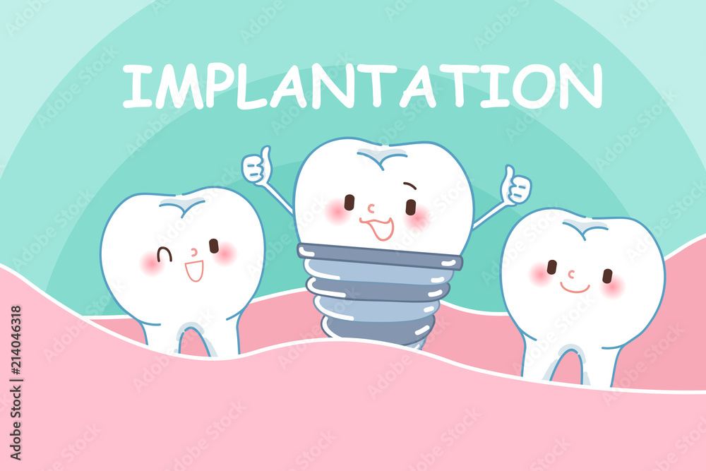 cute cartoon implant tooth cute cartoon implant tooth