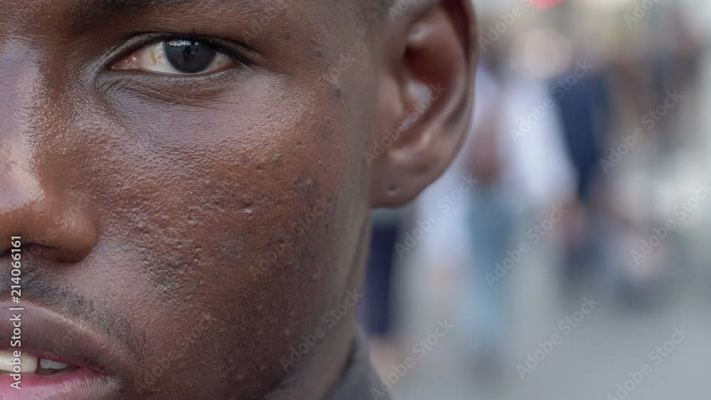 young black immigrant staring at camera- half face- outdoor- slow motion