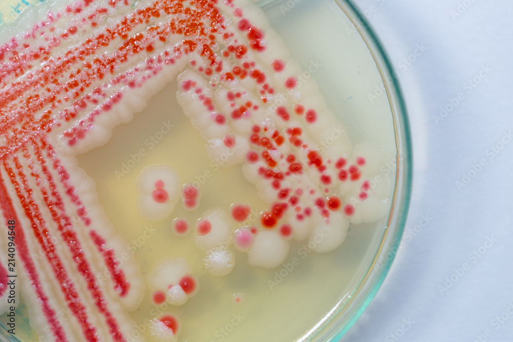 Serratia marcescens is a species of rodshaped gramnegative bacteria