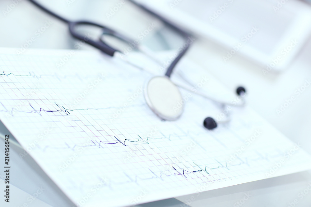 stethoscope and cardiogram on a medical table stethoscope and cardiogram on a medical table