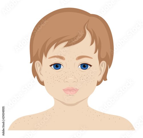 Little girl with freckles photo