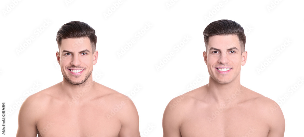 Handsome young man before and after shaving on white background Handsome young man before and after shaving on white background